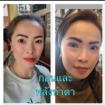 Rangsit Aesthetic Plastic Surgery Clinic