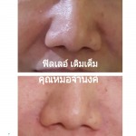 Rangsit Aesthetic Plastic Surgery Clinic