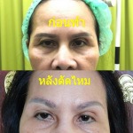 Rangsit Aesthetic Plastic Surgery Clinic