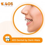 วิธีป้องกันปัญหาขากรรไกรหลังการจัดฟัน - คลินิกทันตกรรม 405 เด็นทัล