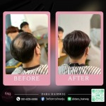 วิกติดกาวผู้ชาย - ร้านวิกผมติดกาว ช่างองุ่น - Dara Hairwig