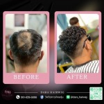 วิกผมผู้ชายติดกาว - ร้านวิกผมติดกาว ช่างองุ่น - Dara Hairwig