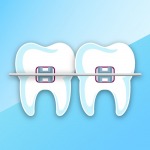 orthodontics - คลินิกทันตกรรมเด็นทัลวิลลา ชลบุรี
