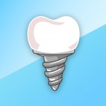 dental implant - คลินิกทันตกรรมเด็นทัลวิลลา ชลบุรี