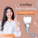 รีวิวจากคนไข้ใช้รากเทียม คลินิกบางแสน