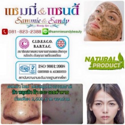 ขจัดสิวหลุมสิว