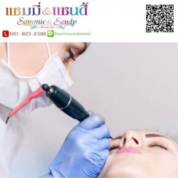 จี้ไฝ ราคาพิเศษ ใกล้ฉัน