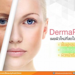 การรักษาหลุมสิว