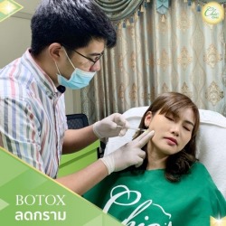 Botox ลดกราม เชียงราย