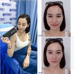 ฉีดฟิลเลอร์ เชียงราย