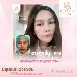คลินิกรักษาสิวระยอง