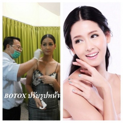 Botox ปรับรูปหน้า - คลินิกศัลยกรรมตกแต่งเสริมสวย รังสิต