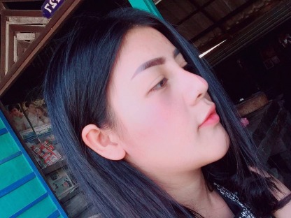 หมอศัลยกรรมทำหน้าวีเชป - คลินิกศัลยกรรมตกแต่งเสริมสวย รังสิต