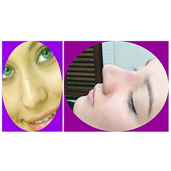 เสริมจมูก ศัลยกรรม   ทำนม   เสริมจมูก   ทำตาสองชั้น   ทำปาก   เสริมหน้าอก   แปลงเพศ   ร้อยไหม   หน้าเรียว   แก้จมูก 