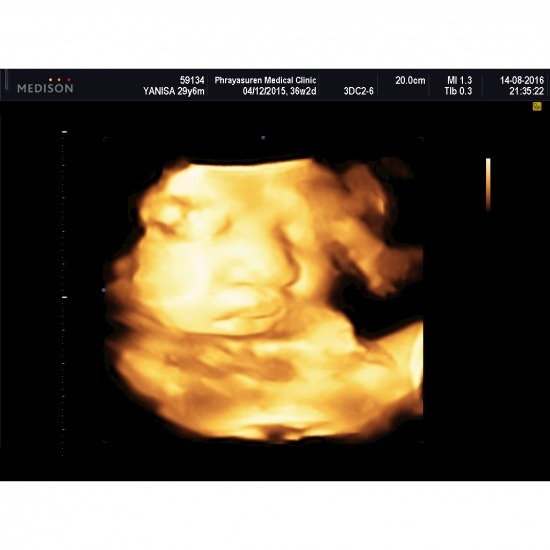 บริการรับอัลตร้าซาวด์ รามอินทรา อัลตร้าซาวด์ 