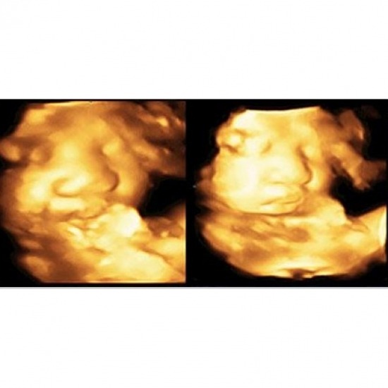 รับฝากครรภ์ รับฝากครรภ์ 