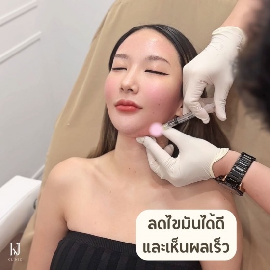 Fat อินทามระ ฉีดโบท็อกรัชดา  ฉีดโบท็อกอินทามระ  Botox ราคาถูก  โปรแกรมหน้าใส รัชดา  โปรแกรมหน้าใส อินทามระ  รักษาฝ้า รัชดา  รักษาฝ้า อินทามระ  รักษาสิว รัชดา  วิตามินผิว รัชดา  เสริมจมูก รัชดา 