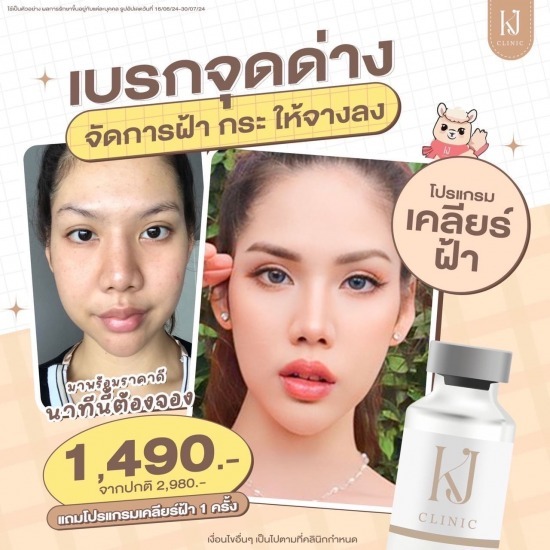 รักษาฝ้า อินทามระ รักษาฝ้า อินทามระ