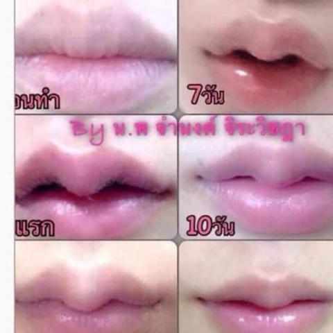 ทำปากกระจับ