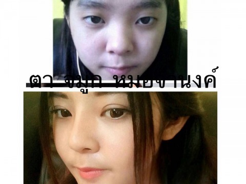 ทำหน้า-ตา-จมูก-เกาหลี